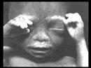 abortion: mercy killingrape illnes your comments answered