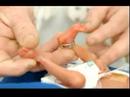 abortion: mercy killingrape illnes your comments answered