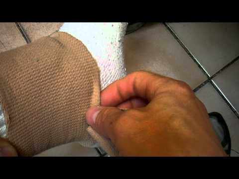 how to properly ice foot