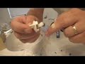 Home Wart Removal Home Wart Removal