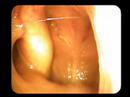 Anatomical Tutorial During Trans-Nasal Endoscopy