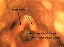 Anatomical Tutorial During Trans-Nasal Endoscopy