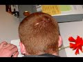 Chemtrails Ultimate Purpose: Increase Bioelectric Conductivy Chemtrails Ultimate Purpose: Increase Bioelectric Conductivy