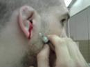Cronin draining his ear Cronin draining his ear