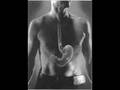 الاسيد بالمعده كيفيه تجنبه والوقايه منه stomach acid 5