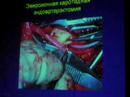 Carotid Endarterectomy
