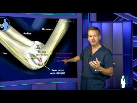 how to relieve cubital tunnel syndrome