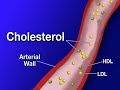 Understanding Cholesterol (Cholesterol #1) Understanding Cholesterol (Cholesterol #1)
