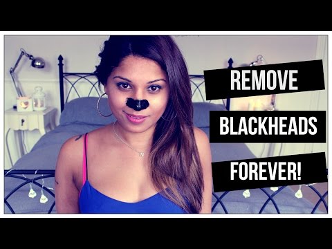 how to remove blackheads