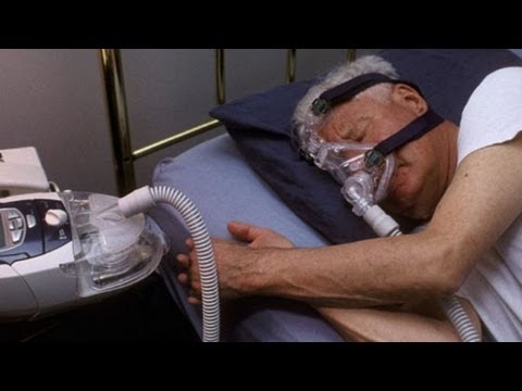 how to cure obstructive sleep apnea