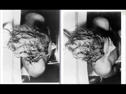 JFK検死警告グラフィックの3D写真