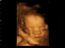 Window to the womb 4d baby scan of sarah and simon Window to the womb 4d baby scan of sarah and simon