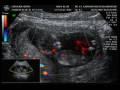 videos de Wili and Caro´s Baby