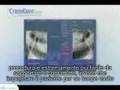 Dott. Federico Colombo - Radiochirurgo. Il Cyberknife