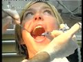 Dentist Injection Dentist Injection