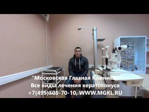 Видео Имплантация стромальных (роговичных) колец