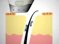 NU SKIN GALVANIC  TREATMENT (PART 2)
