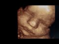 LINDO BEBE CHIQUIMULTECO