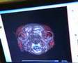 Tomografia Veterinária Helicoidal em 3D na RENALVET