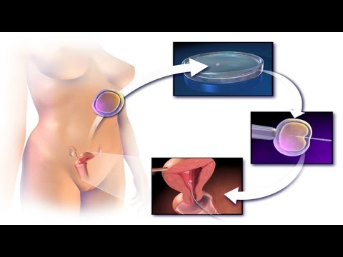 how to collect sperm for ivf