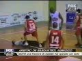 violencia en el deporte violent sports fracturas