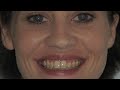 LVI Smile Cosmetic Dentists 1