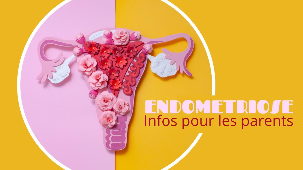 Endométriose : les tampons hygiéniques sont-ils en cause ? - Marie