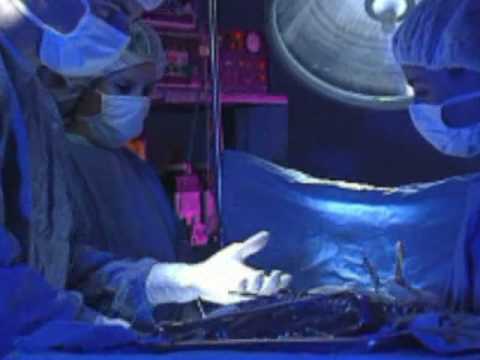 how to get an ovary transplant