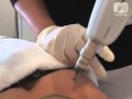 image-thumb