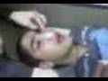 videos de curacion de nariz