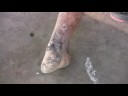 Visiting a leper at her home