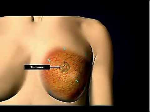 Imagen de previsualización de YouTube