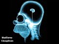 Click here to watch this video CheapBrain/MadSoma