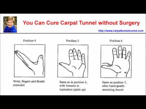 how to relieve carpal tunnel without surgery