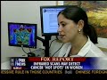 Fox News About Thermography