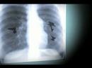 Heinz Top This TV Challenge: \"Heinz - Sticks to Your Ribs\"