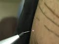 THE FUTURE IS NOW!!elettrodermografie tattoo