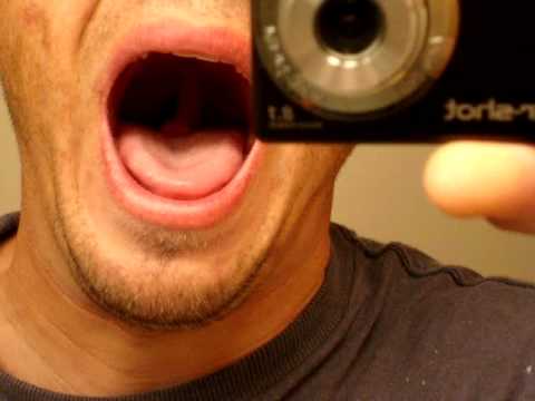 how to get rid of a swollen uvula