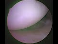 Inside my shoulder
