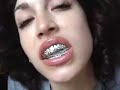 Where da gold at? GRILLLLLLLLLLLLLLL