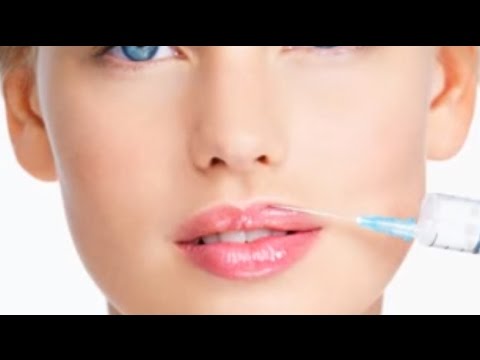 video-gallery