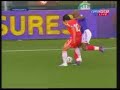this is the accident, 2 days before the world cup, where the liverpool's djibril cisse breakes his leg and miss's the world cup...