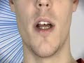 Thumbnail #1