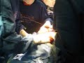 Giving birth to Josiah Graye