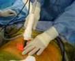 Visiport insufflation in gastric banding