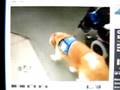 Pit bulls attack a service dog