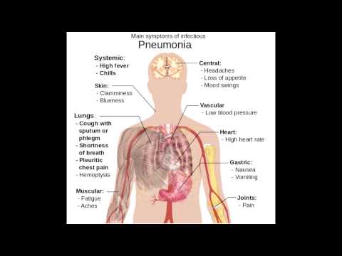 how to relieve back pain from pneumonia