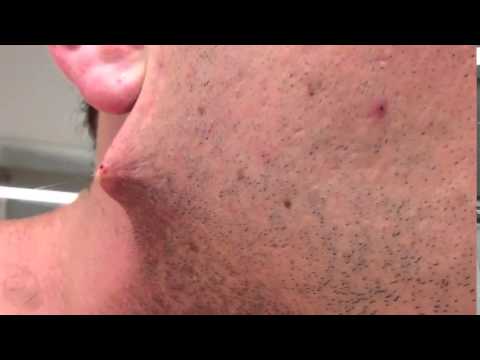 Man shaves his beard off but he got terrified when he found out...