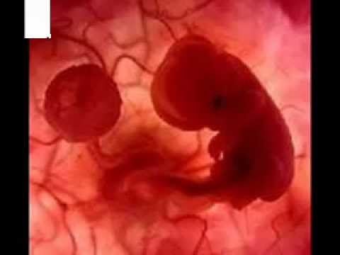 Videos-De-Abortos-Reales de abortos reales - Videos | Videos relacionados con youtube.videos de ...