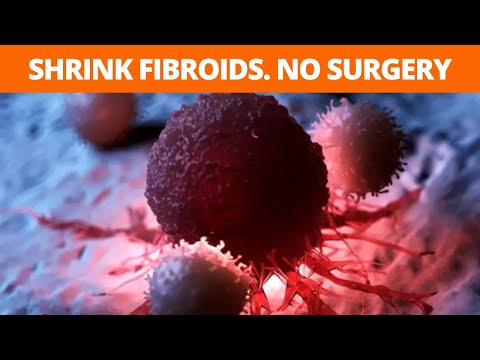 video-linktoworks-Can You SHRINK FIBROID NATURALLY Without Surgery?...